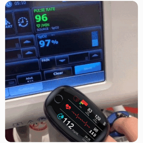 🔥Top Sale OFF🔥 Non-Invasive Blood Glucose Meter